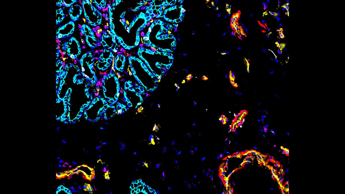 NIH_CommonFund's tweet photo. Are you interested in the inner workings of your #intestines? Then come ruminate on this CODEX image from @_hubmap researcher Dr. John Hickey in Garry Nolan's lab @stanford. We have a gut feeling you'll have a visceral reaction to it! #HuBMAPImage #CellMapCrew #SciArt #BioArt https://t.co/dXxGoYU6OK