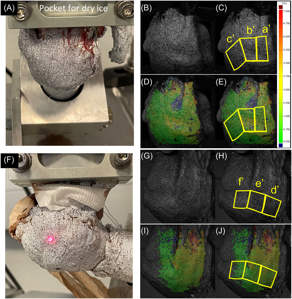 Carly Lockard (@carly_lockard) on Twitter photo Rotator cuff tears are common injuries leading to significant shoulder dysfunction. <a href="/ORSsociety/">Orthopaedic Research Society</a> members <a href="/TYuriOT636/">Takuma Yuri, OTR, PhD</a>, <a href="/GiambiniL/">Giambini Lab</a> & coauthors at <a href="/UTSA/">UT San Antonio</a> contribute to improved understanding of rotator cuff tendon strain distributions: onlinelibrary.wiley.com/doi/10.1002/jo… <a href="/JOrthopRes/">Journal of Orthopaedic Research®</a> #ORSSMC Rotator cuff tears are common injuries leading to significant shoulder dysfunction. <a href="/ORSsociety/">Orthopaedic Research Society</a> members <a href="/TYuriOT636/">Takuma Yuri, OTR, PhD</a>, <a href="/GiambiniL/">Giambini Lab</a> & coauthors at <a href="/UTSA/">UT San Antonio</a> contribute to improved understanding of rotator cuff tendon strain distributions: onlinelibrary.wiley.com/doi/10.1002/jo… <a href="/JOrthopRes/">Journal of Orthopaedic Research®</a> #ORSSMC