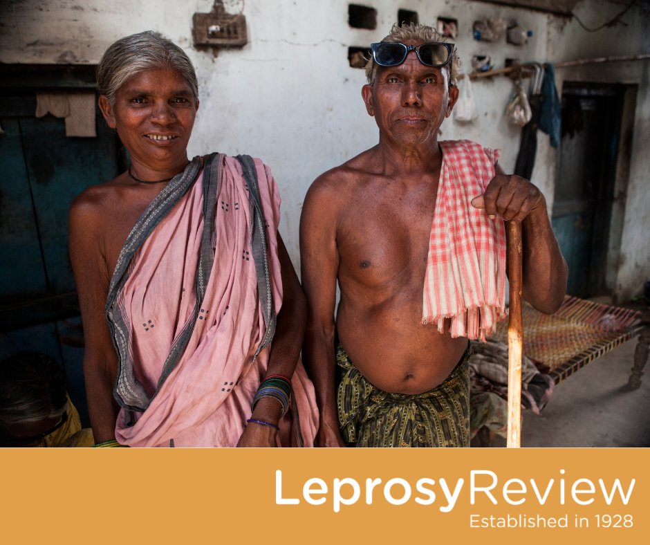 LeprosyReview's tweet photo. π 'Low dose thalidomide and its exquisite responsiveness in steroid dependent ENL β a cost effective treatment & emergent need for trials' by Savitha Bathula, Kabir Sardana & Ananta Khurana
π https://t.co/VvGRm5nwsd
#medicalresearch #research #Medicalcomms #medicine #health https://t.co/H0pHRenIwb