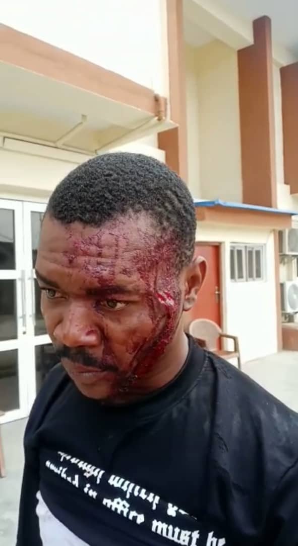 Lere4Peterobi's tweet photo. Today our door to door campaign in Surulere for @OlumideOworu the LP HOA candidate for Constituency 1 was marred by attacks on our convoy by APC thugs who arrived in 2 mini-buses.
Olumide APC Desmond Elliot
@NgLabour 
@GRVlagos https://t.co/voEcDBhlG4