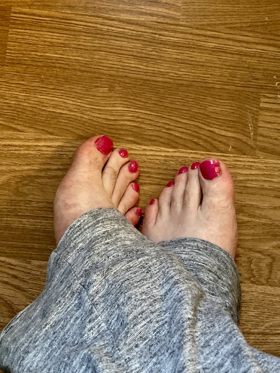 YorkshireSir's tweet photo. Did my toenails for the first time ever #sissy #dollpink https://t.co/Y0sZEywDgW