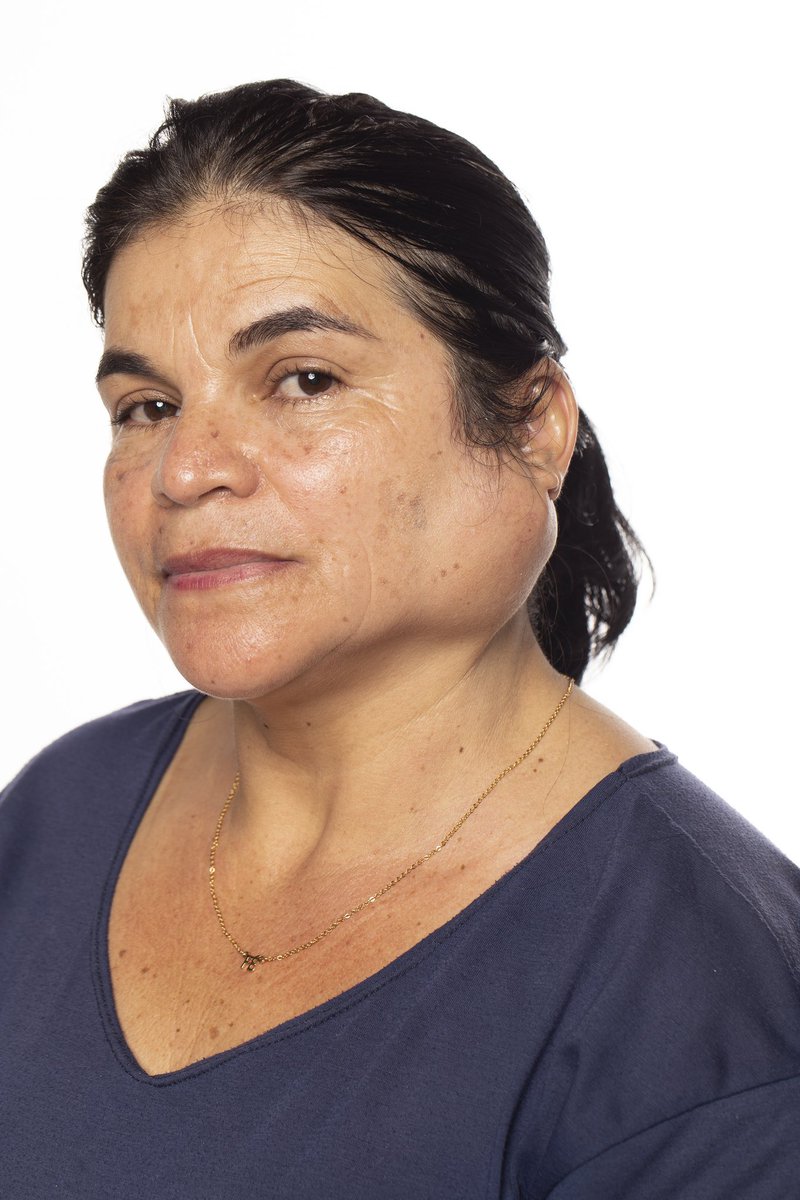 Migos, eu sei a força que o Twitter tem. E por isso vim pedir ajuda a vocês. Pra quem não sabe a cleozinha trabalha aqui no prédio onde é meu estudio. A Cléo está com um tumor como vocês podem ver na foto. Ela espera pela cirurgia a mais de 5 anos. Na rede particular a cirurgia+