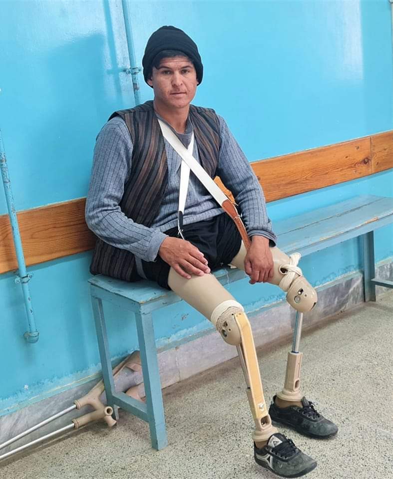 Today, Afghan disabled people do not have access to their rights! They should be given their rights Which is explained by Afghan law and international agreement! افغان معلولين بايد خپل حقه حقوق ترلاسه کړې! دوى زړور انسانان دې