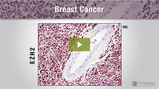 CellPressNews's tweet photo. Epigenetic drivers of breast cancer, the role of histone modifications and epigenetic regulation in driving progression of breast cancer. Watch the video @CellMentor #GetTechnical https://t.co/5W1w1Mv6zb https://t.co/AwizuRM827