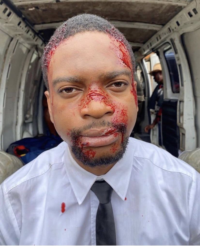 See what they did to Tari 😭😭😭😭😭😭

What the thugs Tinubu and Sanwolu breeds in Lagos did to Tari 😭😭😭😭😭

See our Tari 😭😭😭😭 

My heart is broken for Nigeria 😭😭😭 

Pls VOTE LP 😭😭 Pls