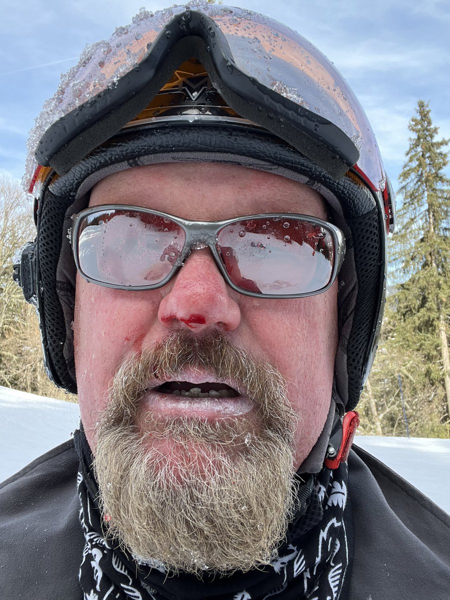 Took one hell of a tumble at high speed today, very glad I was wearing a helmet. Huge thanks to the other skiers who put me back together. The three pillocks who stood there laughing, screw you!