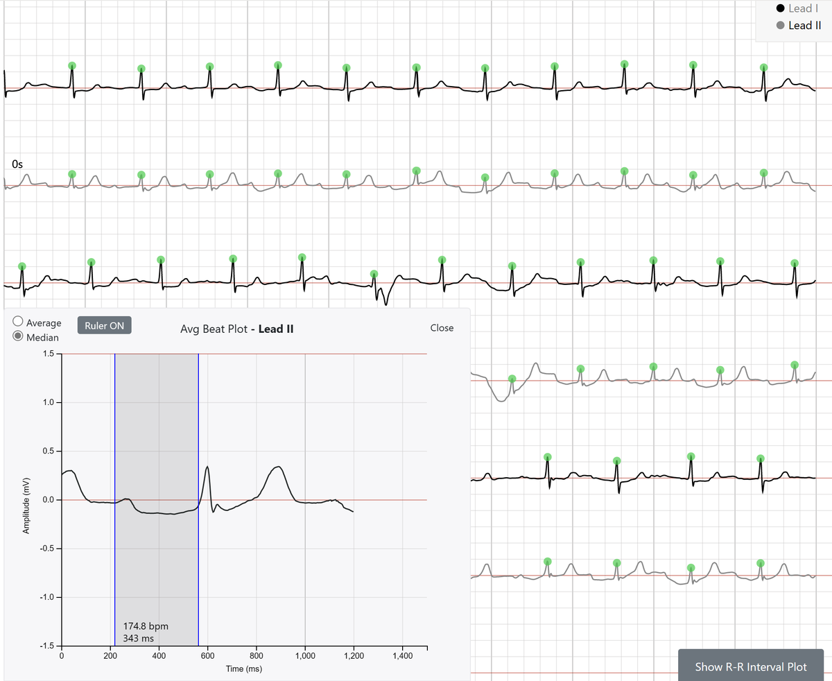 David E. Albert, M.D tweet media