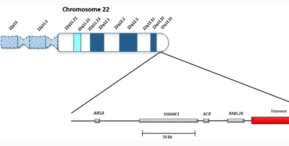 𝗣𝗛𝗘𝗟an-Mc𝗗𝗘𝗥𝗠𝗜𝗗

𝗗𝗘letion at t𝗘𝗥𝗠inal end of 22q (22q13.3)
𝗜𝗗 (int'l disb)
↓ pain percpt'n, ↓ sweating ('Mc𝗗𝗘𝗥𝗠𝗜𝗦')
𝗣𝗛𝗘𝗟𝗔𝗡: '𝗣𝗛𝗘𝗟eshy' (Fleshy) h𝗔𝗡ds 🤲
𝗦𝗛𝗔𝗡𝗞3 mut/del (𝗦𝗛𝗔𝗞e h𝗔𝗡ds🤝)
Seizures (SHANK3 mut makes u 'SHAKE')

#GeneChat
