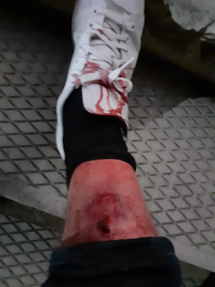 naiz_info's tweet photo. Denuncian cargas «desproporcionadas» e «indiscriminadas» de la Ertzaintza en los aledaños de Anoeta  https://t.co/MJBtJv1zFW https://t.co/7JOkjIZPcj