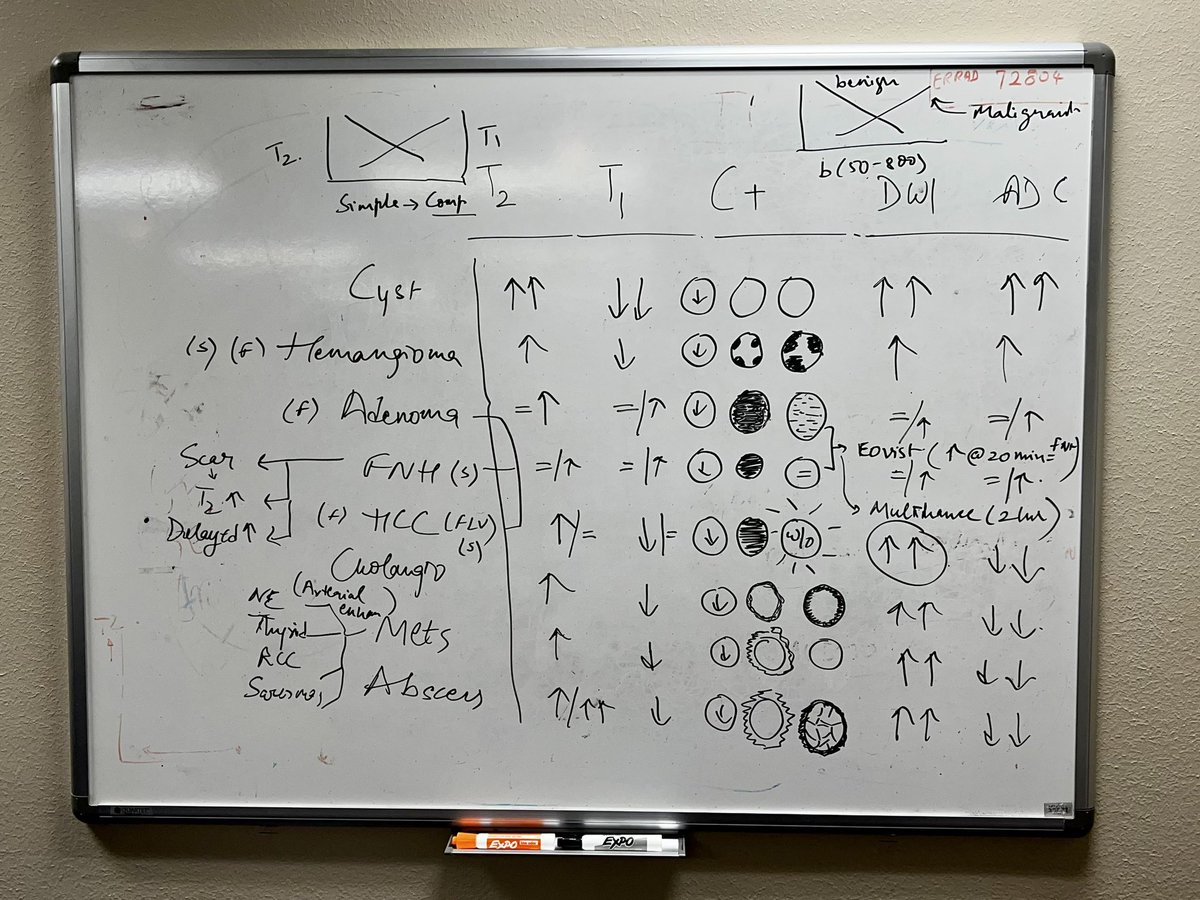 MdPeeyush's tweet photo. A whiteboard teaching session with the @UtmbRadiology residents on MRI of liver lesions. Love this stuff!! https://t.co/tGZsWdDJhe