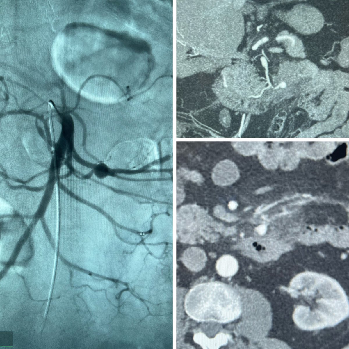 Alexandria CVIR tweet media