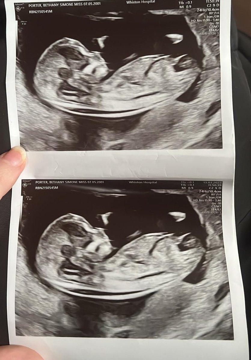 rougeredrojo's tweet photo. My grandbaby #FeelOldButExcited https://t.co/hxMzfAxiKU