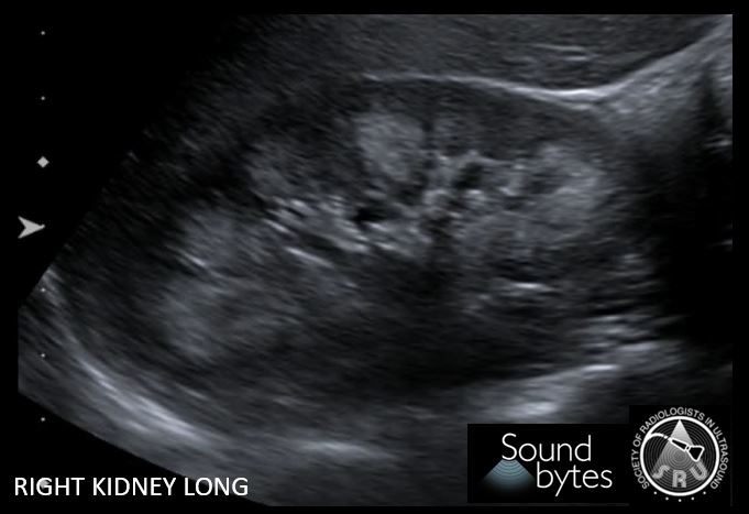 SRU Radiology tweet media