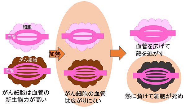 vegal2392's tweet photo. 硬化がかなり進んでいる方に必ず「最後に風邪を引いたのはいつですか？」と聞くようにしているんですが、共通して何年スパンで引いていない。風邪を何年も引かないことは全く喜ばしいことではなくて、湯船や蒸しタオルするという外的な温める行為も良いですが、一番は内部熱で風邪で硬化が取れること。 https://t.co/1jNgmSjMT3