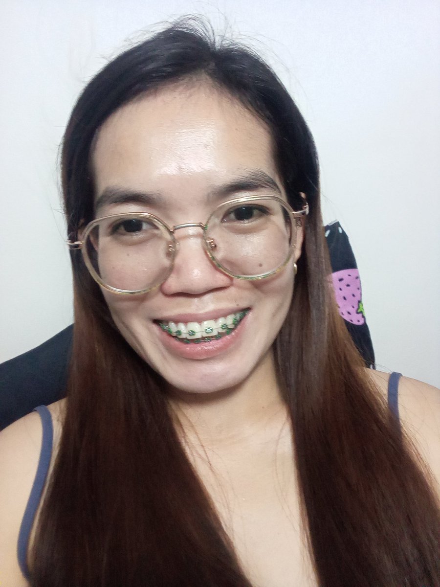Rolieme22's tweet image. 95th day of braces 😁

#overbite