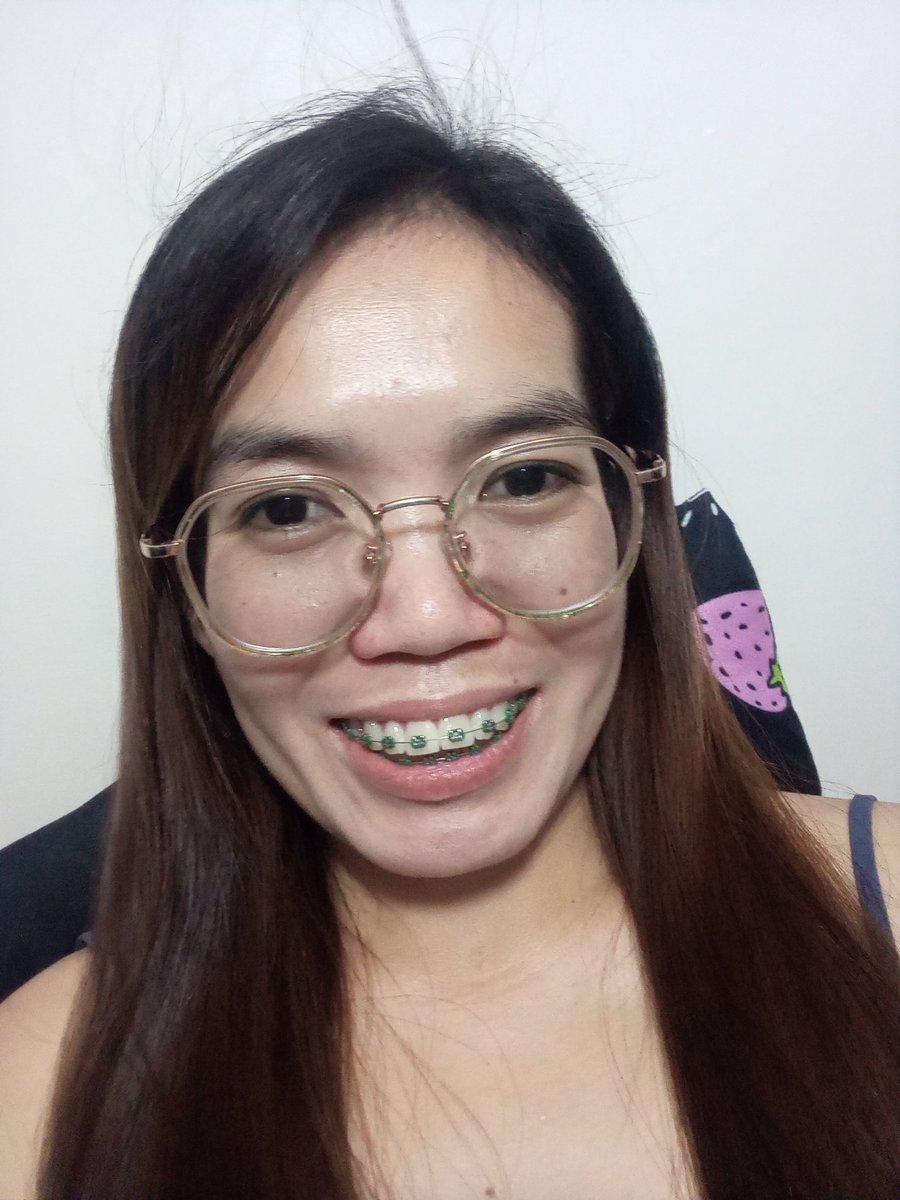 Rolieme22's tweet image. 95th day of braces 😁

#overbite