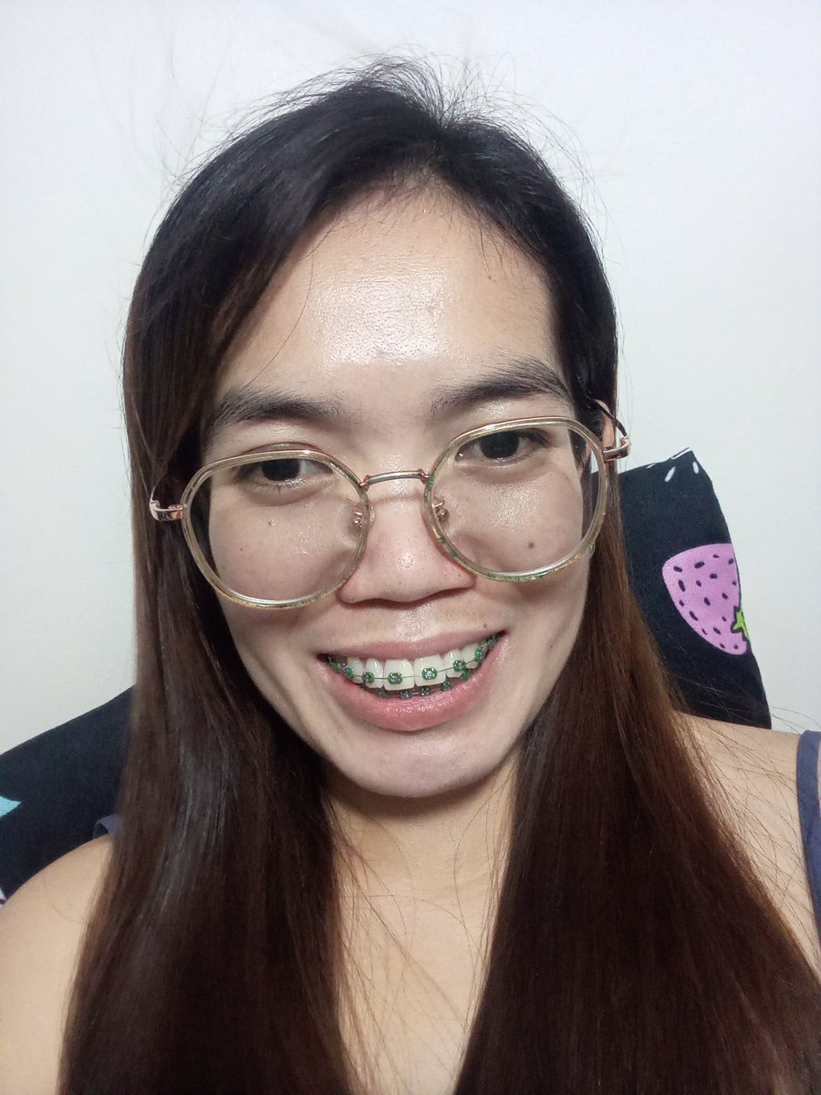 Rolieme22's tweet image. 95th day of braces 😁

#overbite