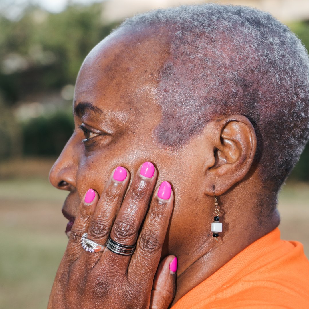 PsoriasisIFPA's tweet photo. Psoriatic disease doesn't discriminate, and neither should our images. Join IFPA to raise awareness of diversity among people living with psoriatic disease. Submit your selfies to All the Colors We Are!
https://t.co/glX3UpKpf8
#psoriasis #skinclusivity https://t.co/YfZH9f3DJw