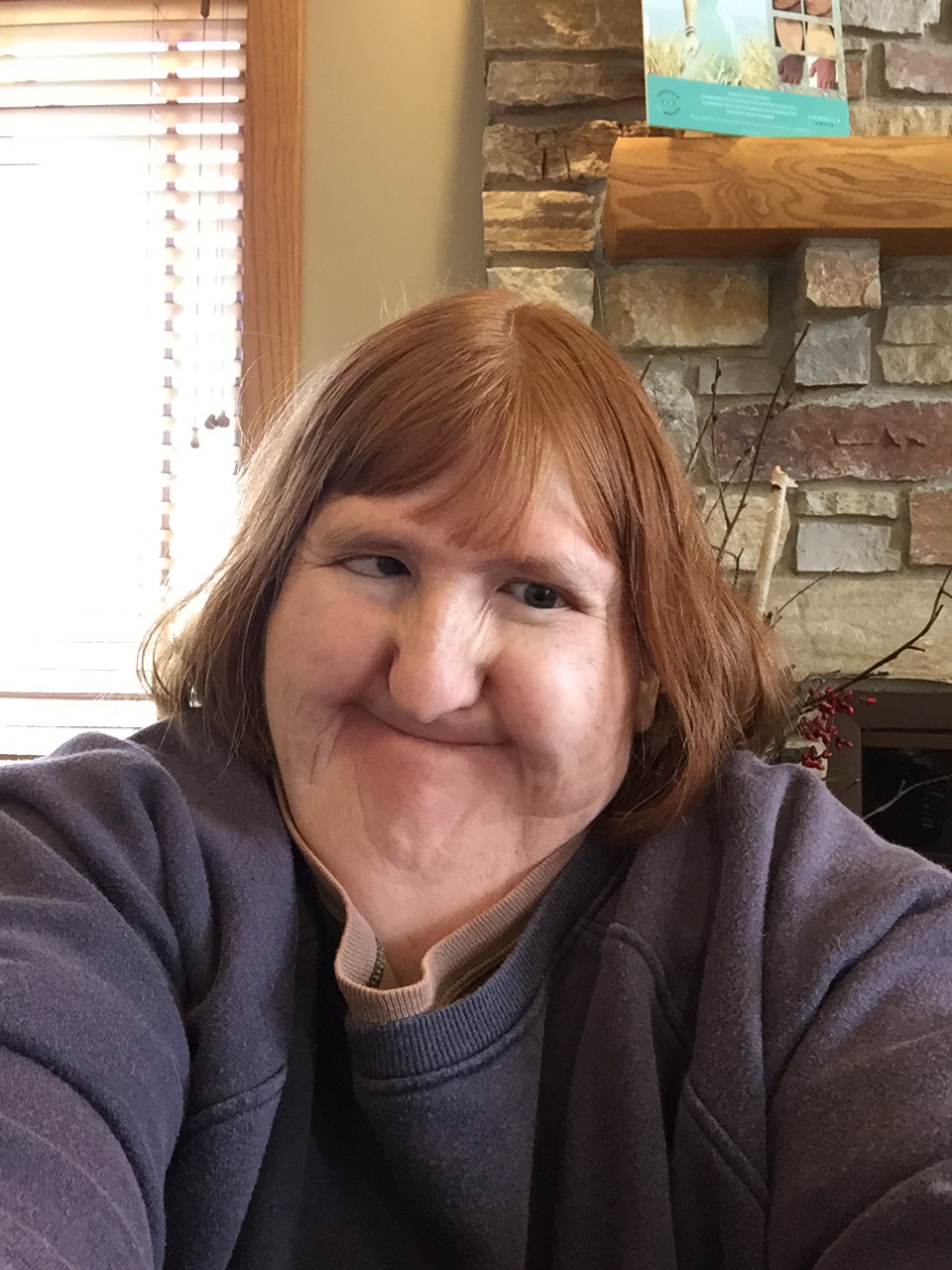 Melissa Blake on Twitter "Dentist selfie! We need to talk about