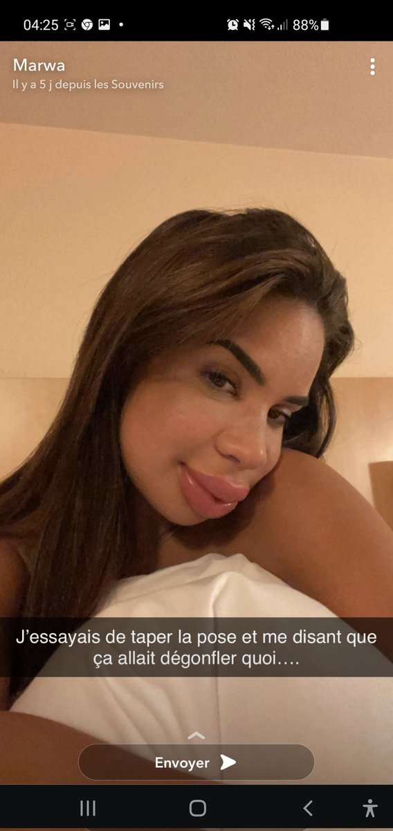 blackcurvystyle's tweet photo. 🔴 Gossip_ L'influenceuse Marwa qui avait tout révélé sur ses injections ratées il y'a quelques mois (vous vous souvenez ?), a été filmée en train d'insulter un chauffeur de taxi.
Elle provoque la colère des internautes. https://t.co/sabfeetvrG