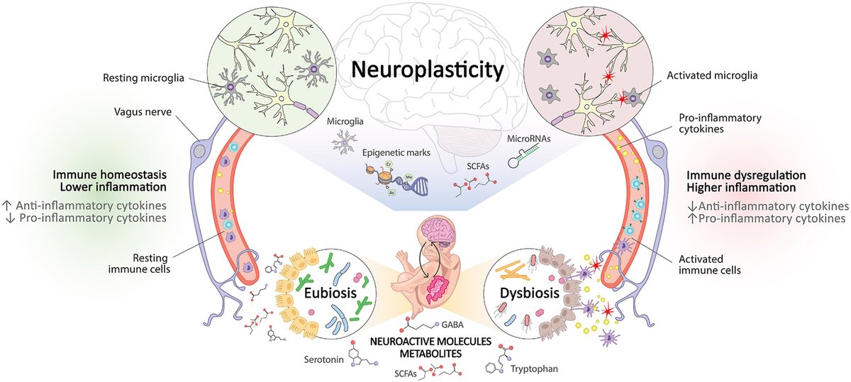 jfcryan's tweet photo. The gut-brain connection: Exploring the influence of the gut microbiota on neuroplasticity and neurodevelopmental disorders 
From @paola_tognini &amp; colleagues in Neuropharmacology
 https://t.co/nE4DxOeWyF https://t.co/pFsEV7ULpY