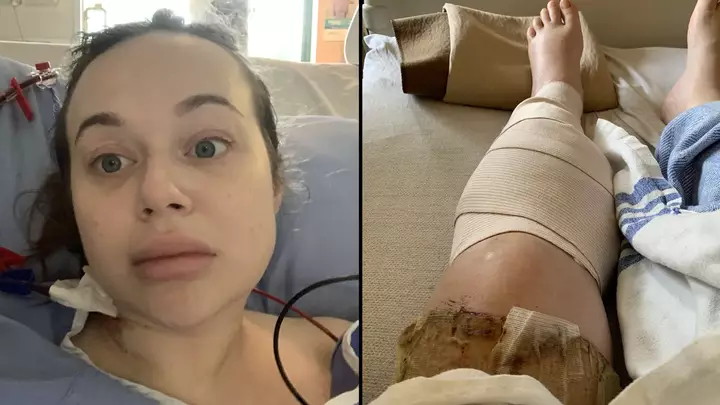 ladbible's tweet photo. 🔔 | Woman almost needed legs amputated after waking up from drinking 'a lot' of vodka on night out

More below 👇 https://t.co/DS9A12SqWc