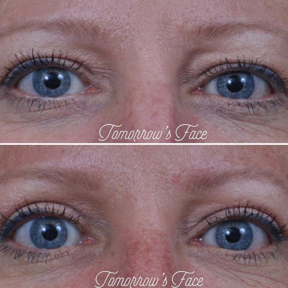 TomorrowsFace tweet media