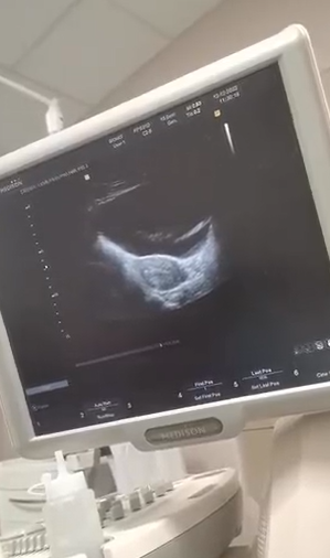 Zalebs's tweet photo. Moshe Ndiki is going to be a father of twins. Congratulations are in order!
https://t.co/0QwYHyixjS https://t.co/8mwh7Ynpyg