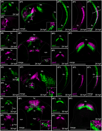 DevelopmentalDy's tweet photo. In central nervous system (#CNS) development, transcription factors determine regional #neuronal cell identity, #connectivity, and function. Learn how #Gsx2 is necessary for #forebrain patterning and long-term survival in #zebrafish @bergeronlab_zf https://t.co/QkbTLUZjvU https://t.co/X6DPmPXMVE