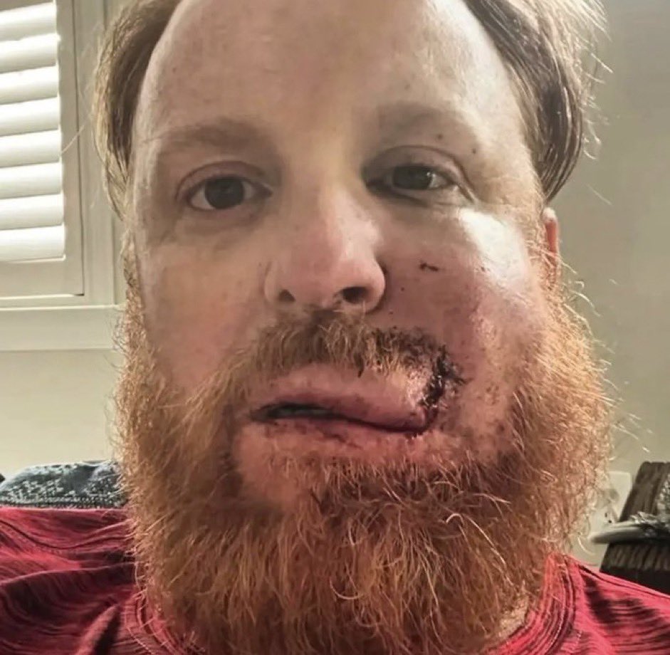 Justin Turner’s face after getting hit by a pitch is insane.

Absolute badass <a href="/StoolBaseball/">Barstool Baseball</a>