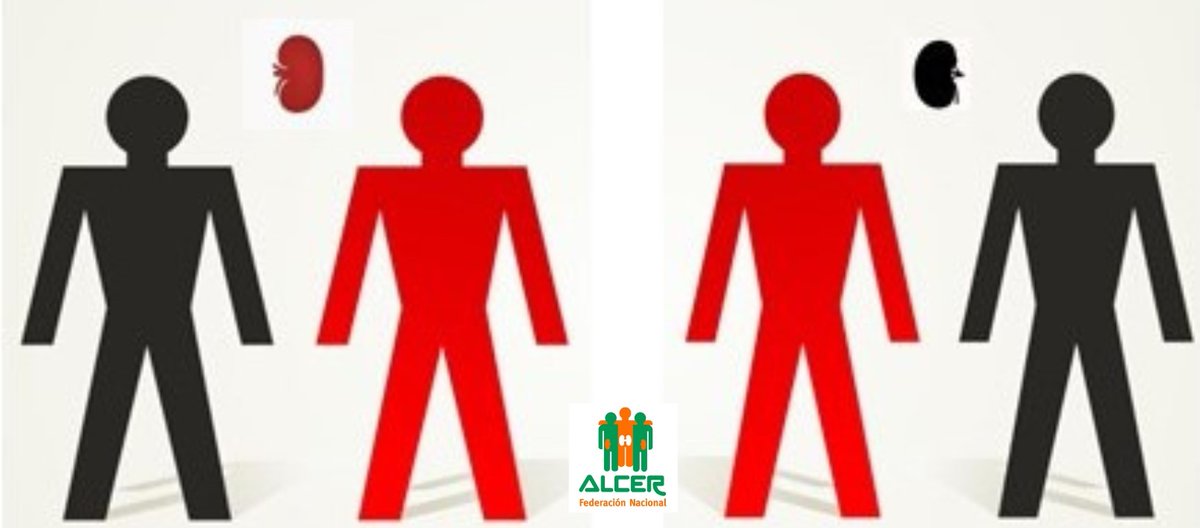 FNALCER's tweet photo. ¿Sabías que existe el trasplante renal cruzado? Es un trasplante renal de donante vivo, con la peculiaridad de que se realiza entre un donante y un receptor que no se conocen, fruto de un intercambio entre los donantes de dos o más parejas que son incompatibles. #DNT23 https://t.co/gCP2hjPjVn