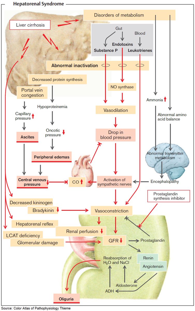 ManualOMedicine's tweet photo. Pathophysiology of Hepatorenal Syndrome

#medtwitter #foamed #meded #usmle https://t.co/KIFJfZFwVM