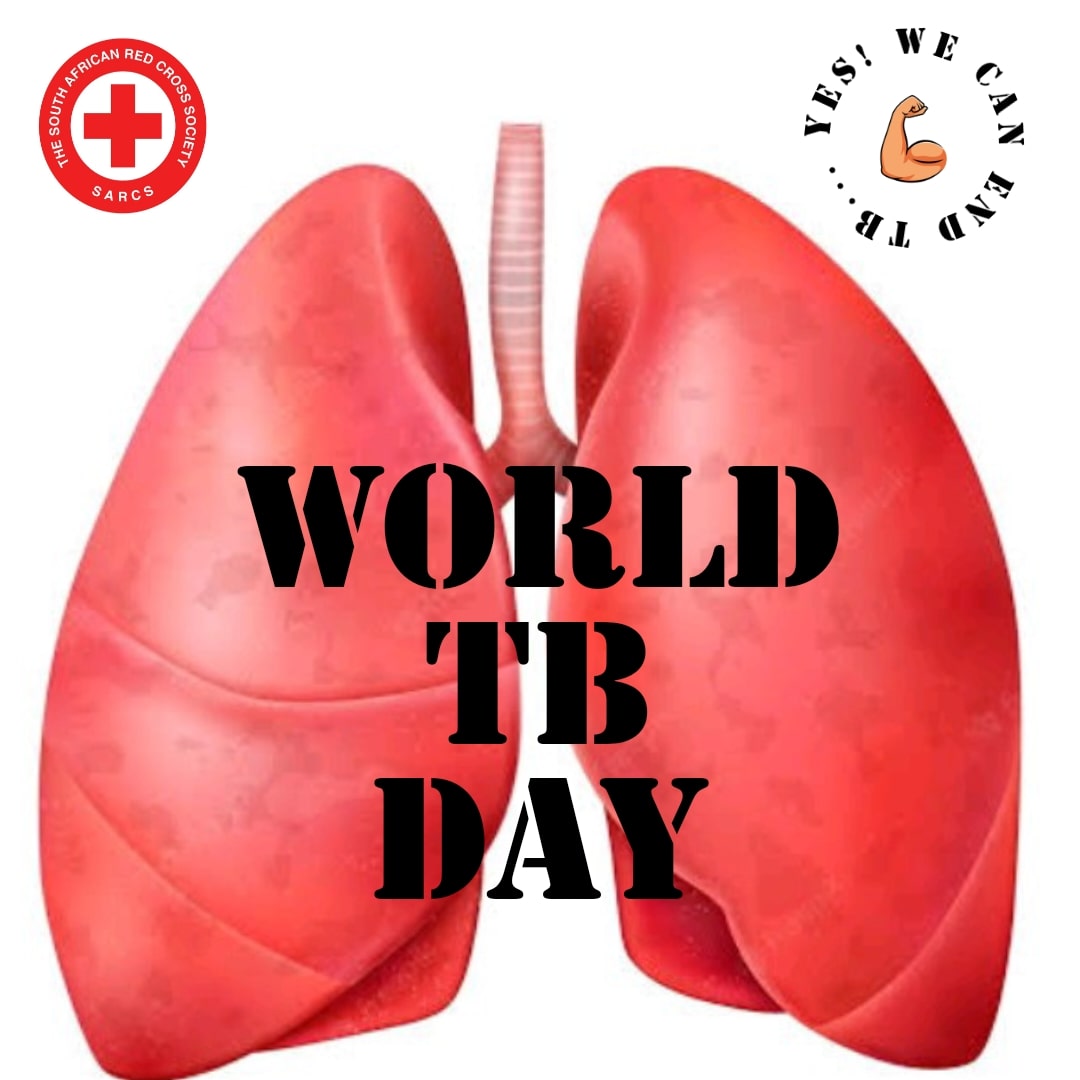 sarcs_y's tweet photo. South Africa lies in the 10 in world with Tuberculosis cases. Death rate has increased significantly to more than 10% from the year 2016.
We encourage you to educate &amp;  protect yourself from this respiratory malady. #YesWeCanEndTB https://t.co/h6CroOPOBL
