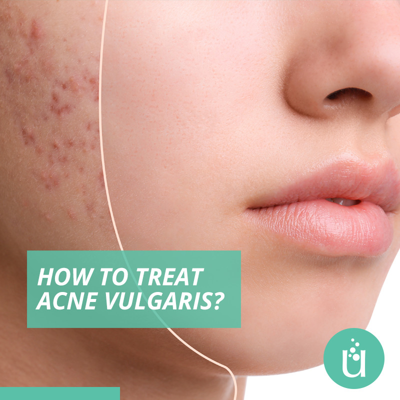 KureLab's tweet photo. Is sarecycline, minocycline, or doxycycline better to treat acne vulgaris? Stay tuned to see what rat testing showed us...
#SkinCare #Dermatology #KureLab #natureandscience #scienceandnature
Source: Dermatology Times https://t.co/7D7anK5xTa