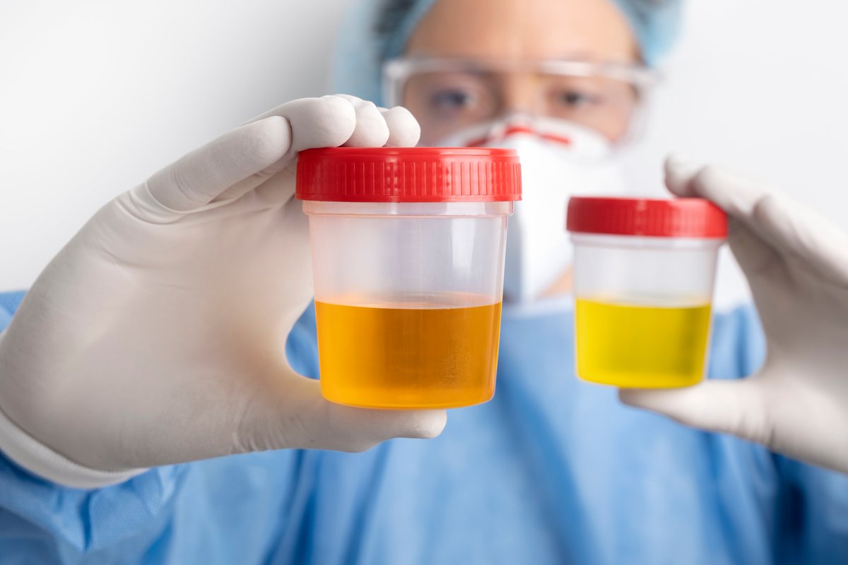 gTtVIH's tweet photo. #CROI2023 Una prueba rápida en orina permitiría medir la adherencia al tratamiento antirretroviral
🔸El test permitiría su uso en centros comunitarios y permitiría predecir el riesgo de fracaso del tratamiento antirretroviral
▶️ https://t.co/VvfosJB9sZ https://t.co/uAZlEaL4Vy