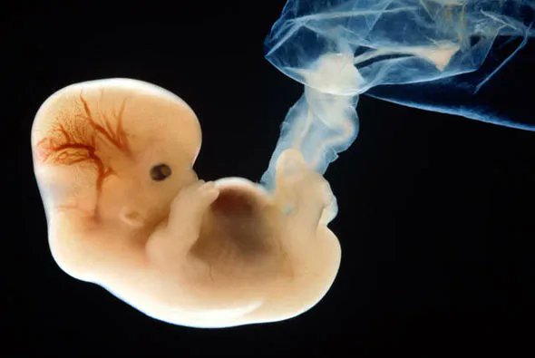 LifeNewsHQ's tweet photo. VICTORY! Florida House Committee Passes Bill Banning Abortions on Babies With Beating Hearts https://t.co/qgOeTrcea7 https://t.co/1LLpLoQX8V