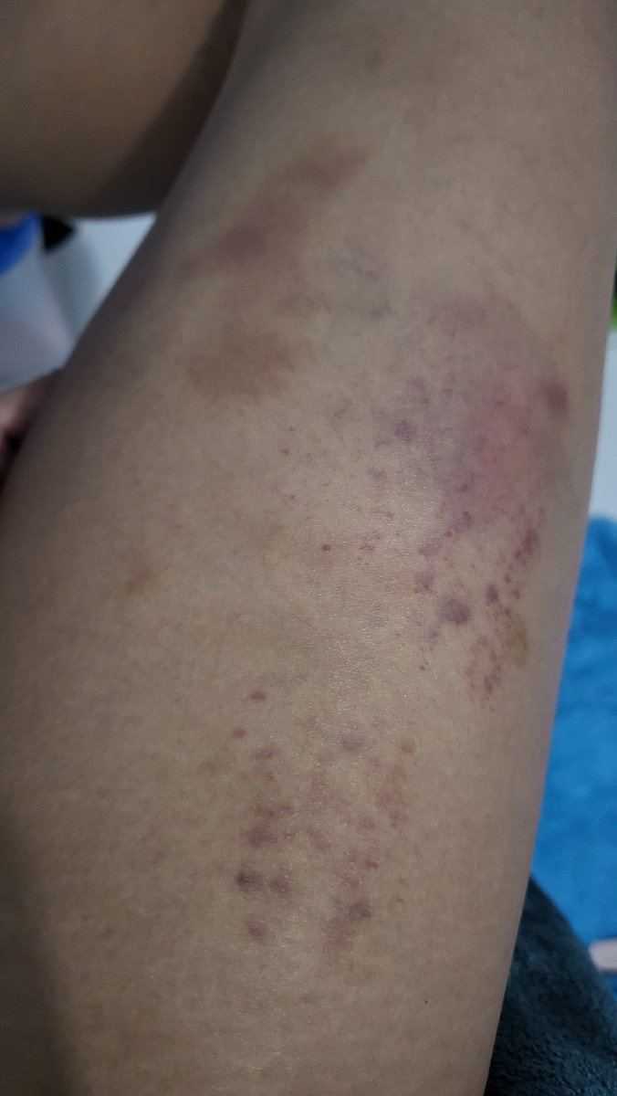 Marr🧘♀️ tweet media