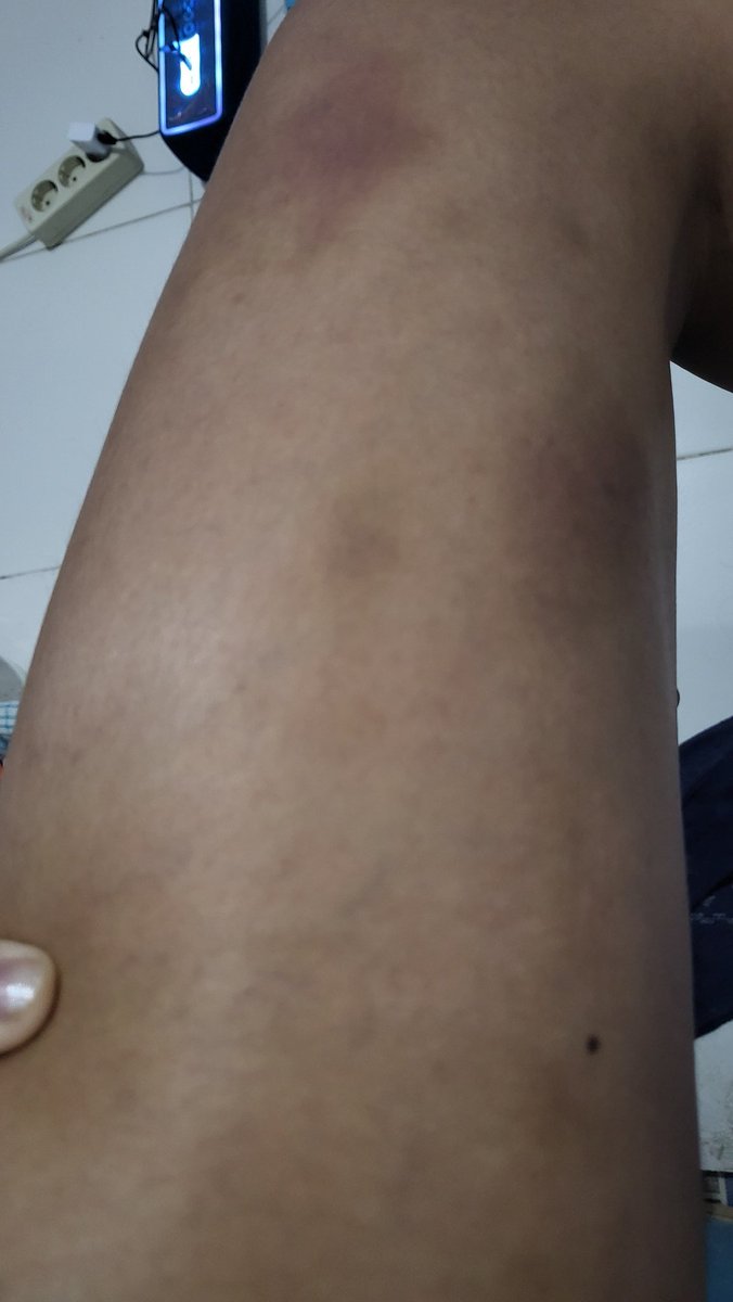 Marr🧘♀️ tweet media