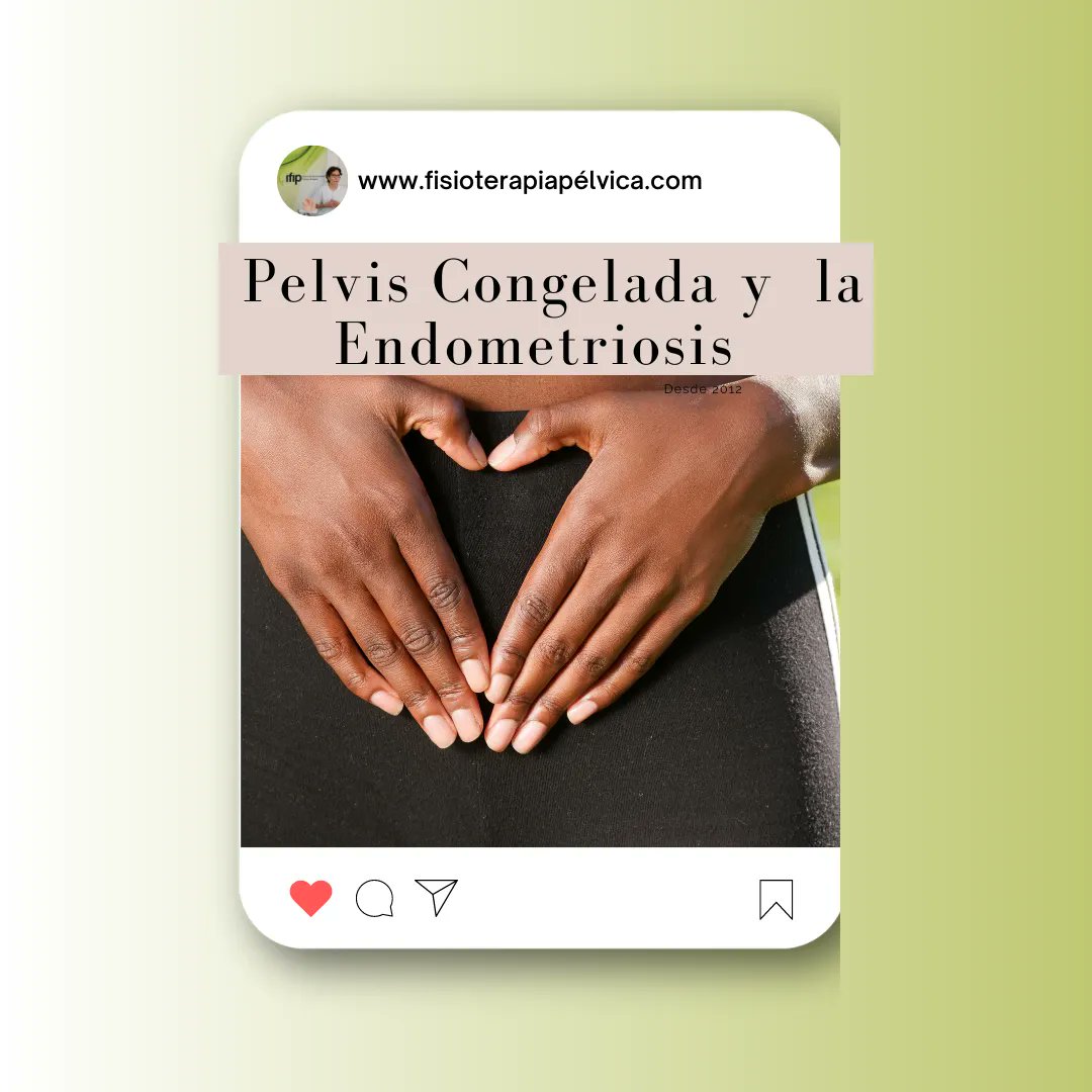 A través de la fisioterapia integral, y el enfoque en suelo pélvico podemos tratar afecciones como la pelvis congelada una consecuencia de la Endometriosis, provocando dolor debido a las adherencias formadas en la zona. 
#endometriosis #fisioterapia