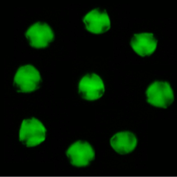 DrAnnPower's tweet photo. Happy St Patrick's Day! Here are some oak (Quercus robur) pollen grains captured by #imagingflowcytometry. The green colour comes from their autofluorescence. #oak #pollen #nature #science #microscopy #palynology #biology #science https://t.co/FDkL8O9XII