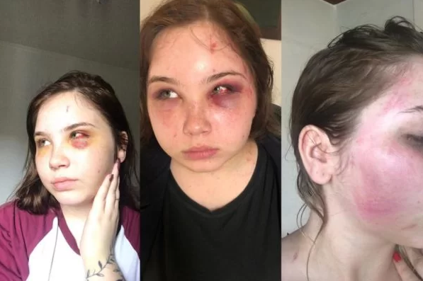 revistaforum's tweet photo. ÁUDIO: cantor sertanejo bolsonarista vira réu por agredir a própria filha durante anos

Incentivada pelo namorado, ela conseguiu gravar o pai fazendo ameaças à ela, inclusive com armas de fogo

Leia mais: https://t.co/0iOixresxu https://t.co/ta5av7Evmi