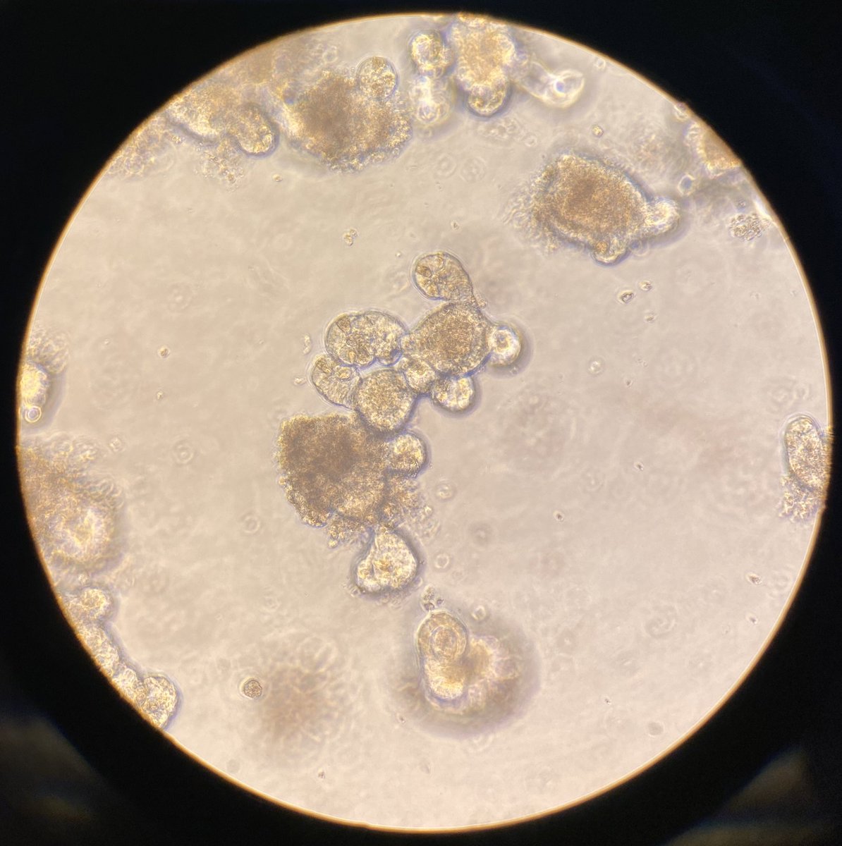 paulamartos's tweet photo. What better way to end the week than to see your intestinal organoids finally grow after a few failed attempts?🔬🧫 #intestinalorganoids https://t.co/MlLZ9GVVN1