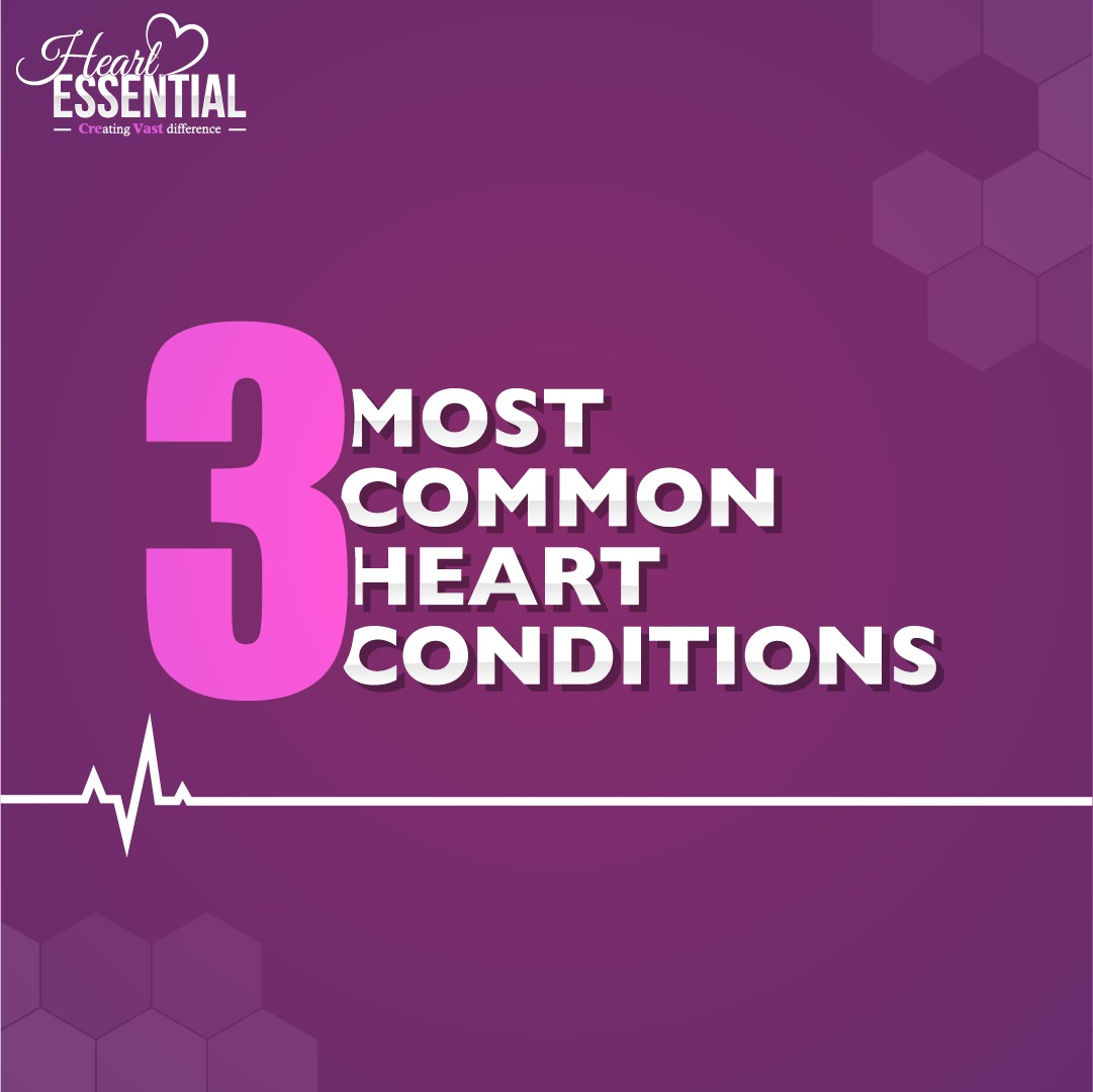 HeartEssential2's tweet photo. Knowing the signs and symptoms can help in early detection and avert cardiovascular complications. 

#hearthealth #healthyheart #heartdisease #heartattack #stroke #heartcare #heartessential https://t.co/YGggEwfPBG