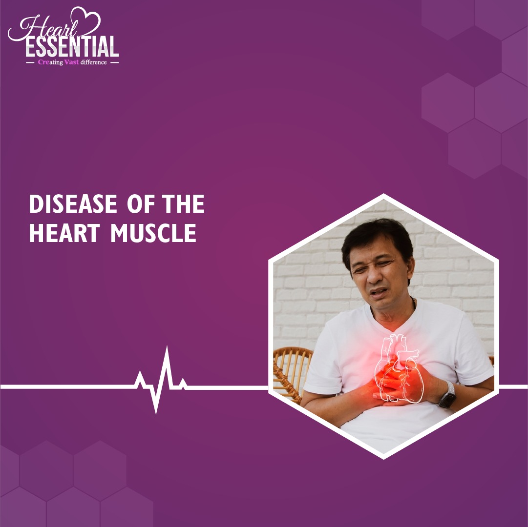 HeartEssential2's tweet photo. Knowing the signs and symptoms can help in early detection and avert cardiovascular complications. 

#hearthealth #healthyheart #heartdisease #heartattack #stroke #heartcare #heartessential https://t.co/YGggEwfPBG