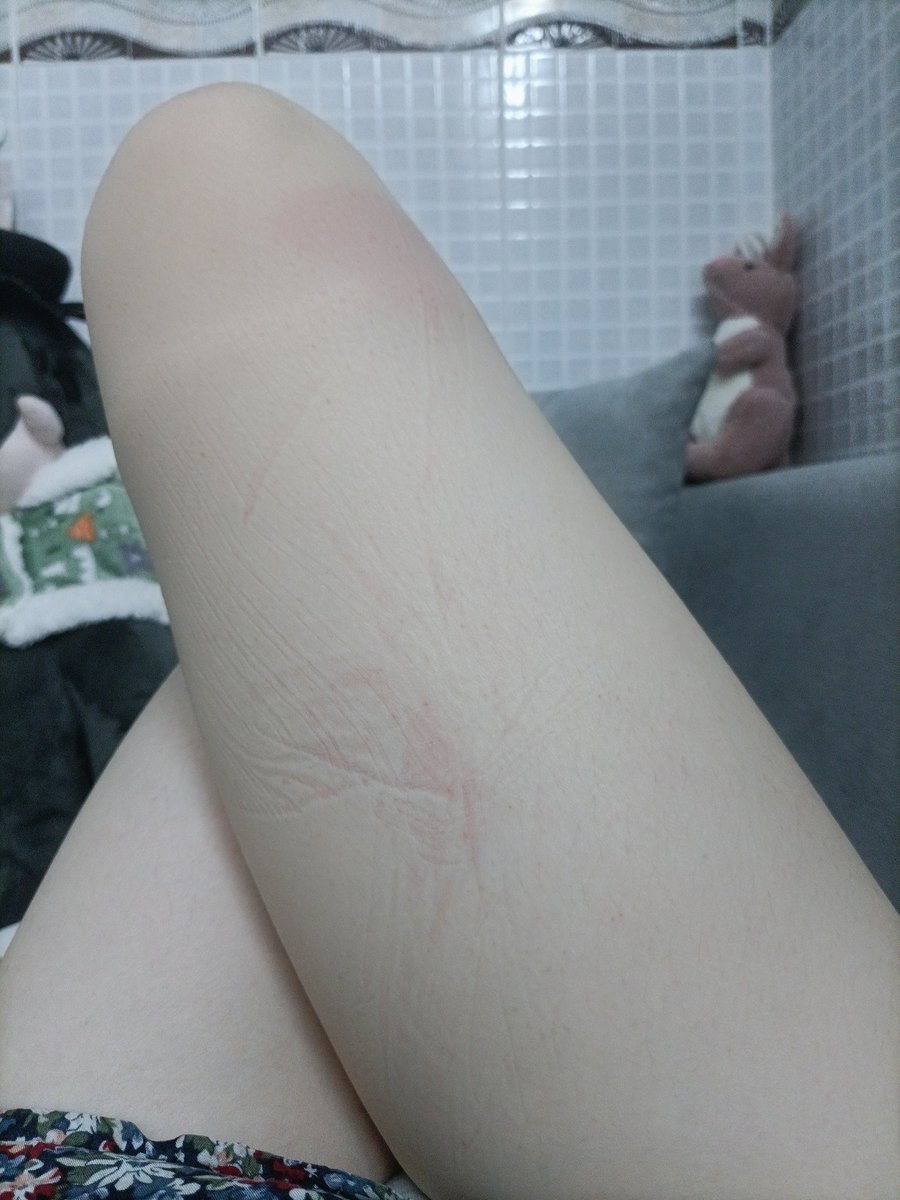 BJGS_'s tweet photo. 如果不是压痕，是绳痕就好了。#sub https://t.co/bauK1jwtKQ