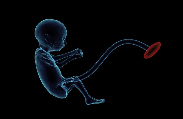 DennisShonko's tweet photo. #MSAMIATI
KIUNGAMWANA
(Umbilicalย cord) https://t.co/llwArRUgim
