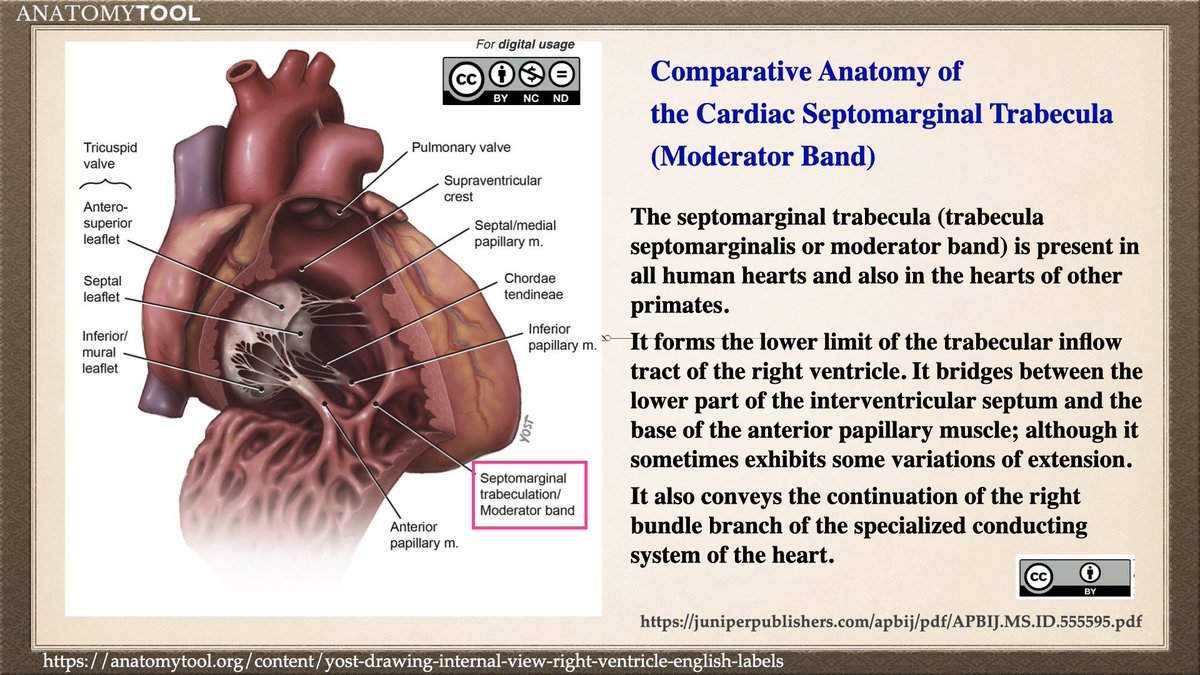 N. Tsukishima EP大学心電図検定学部試験対策科担任 on Twitter "【Moderator band】の別名が