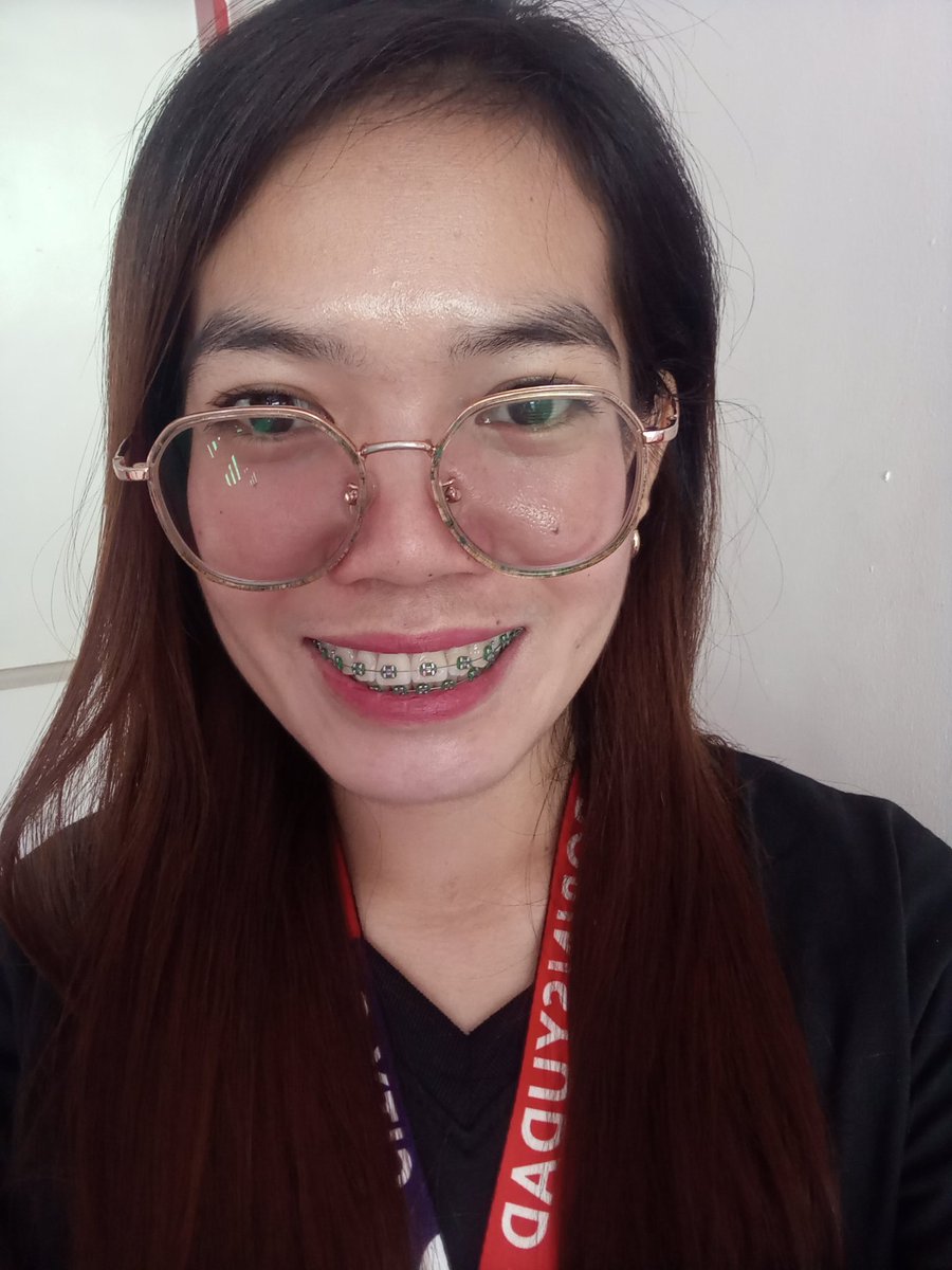 Rolieme22's tweet image. 96th day of braces 😁

#overbite