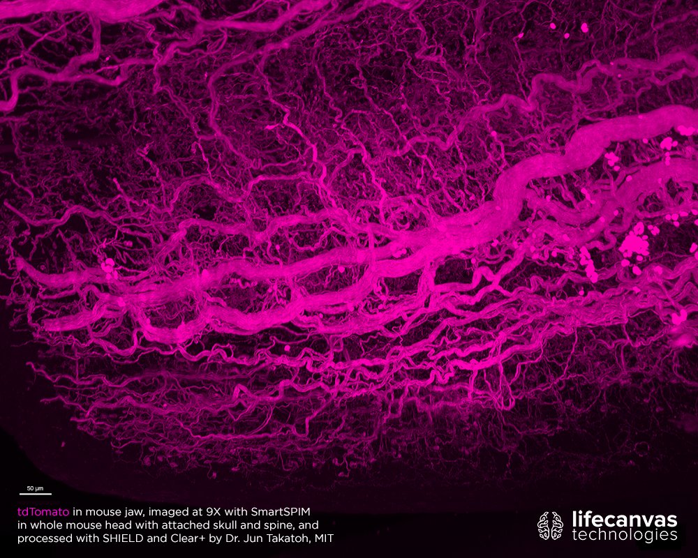 LifeCanvasTech's tweet image. Can you believe these #FluorescenceFriday #SmartSPIM images all come from the same sample? At 9X, you can see fine details like neuromuscular junctions in a whole mouse head with attached skull and spine. Sample was processed with our techniques by Dr. @jun_takatoh @mcgovernmit.