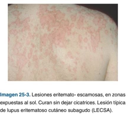 NicoV2516's tweet photo. LES en adultos:
- Prevalencia: Mujeres
- Síntomas comunes: fatiga, dolor articular y perdida de peso involuntaria
- compromiso musculoesquelético: 90% mucocutáneo: 80%
Gastrointestinales : 40% https://t.co/xJr5hqToAA